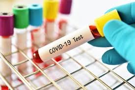 National Manufactures of COVID testing kits desires the ban to be uplifted