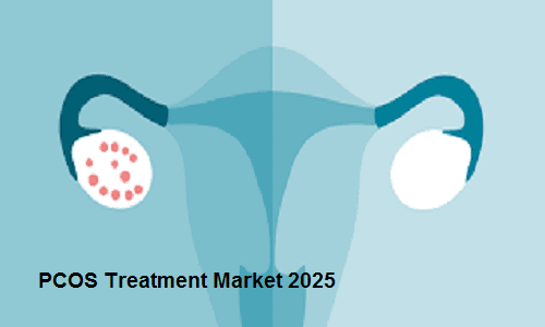 PCOS Treatment Market to Witness Significant Growth until 2025 – TechSci Research